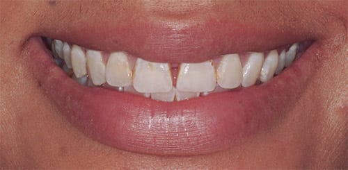 clinica stomatologică Dental Prosmile